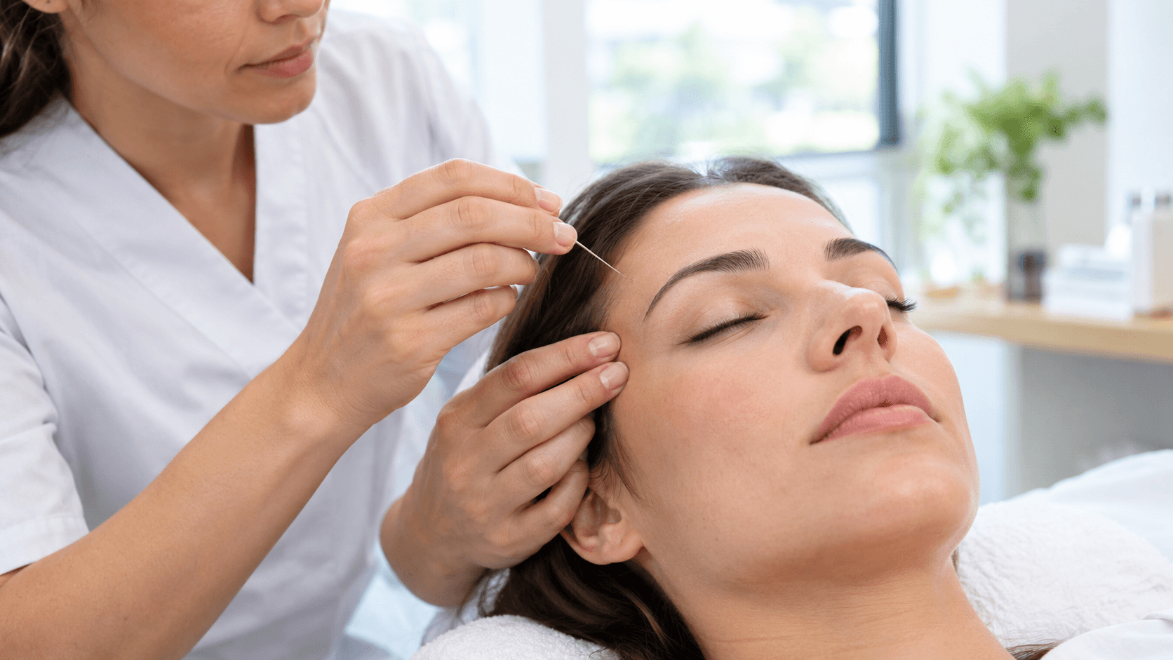 Acupuncteur posant une fine aiguille stérile près de la tempe d'un patient détendu, en prévention des migraines.